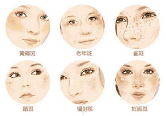 雀斑网红吃瓜,揭秘娱乐圈幕后真相